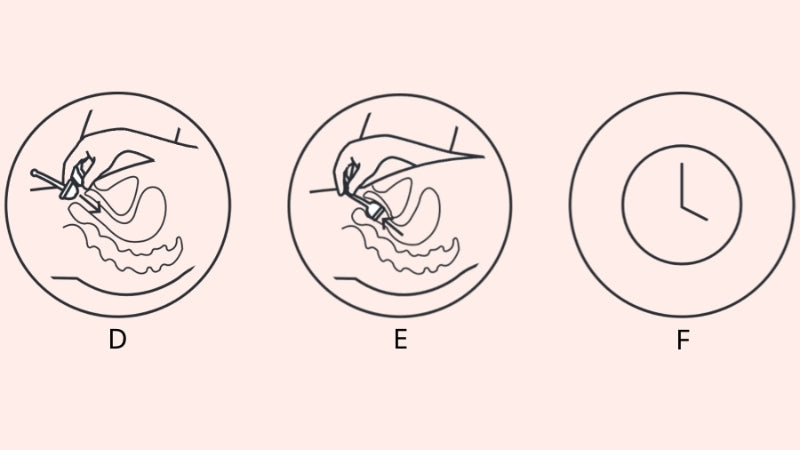 Anwendung der Fertilily Empfängnishilfe